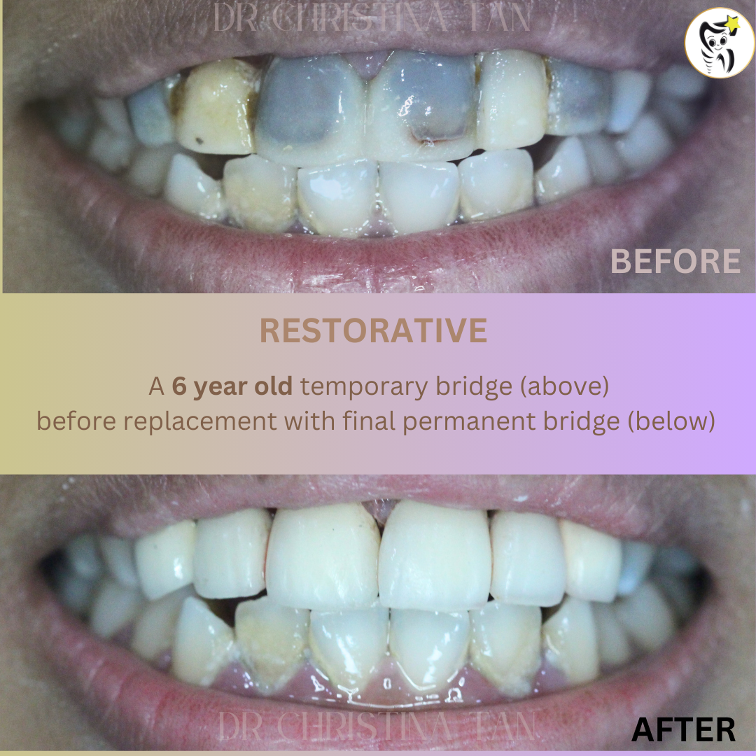 Before and After Dental Treatment