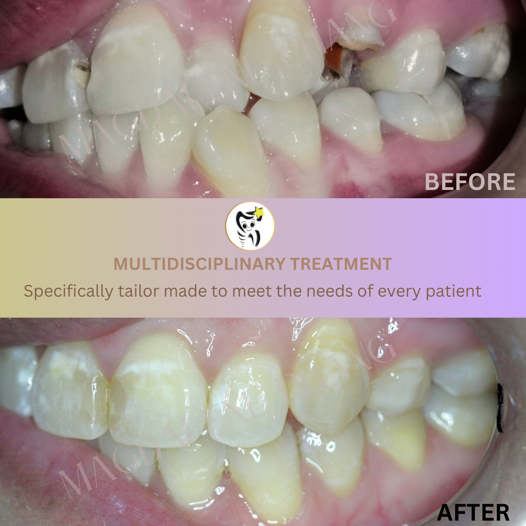 Before and After Dental Treatment